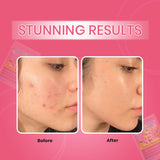 Turmeric kojic acid pads
