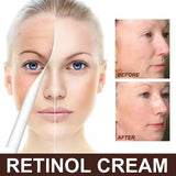 Whitening Moisturizing Bee Venom Facial Care Cream